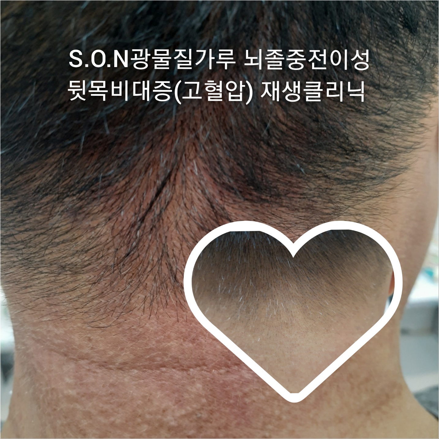 cf84174b852c4338c2225fe55c57baea_1741750676_9319.jpg